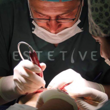 Avatar profil-utilizator/estetive-implant-de-par-2944-80/estetive-implant-de-par-medicina-estetica-servicii-medicale--20191214215217.png